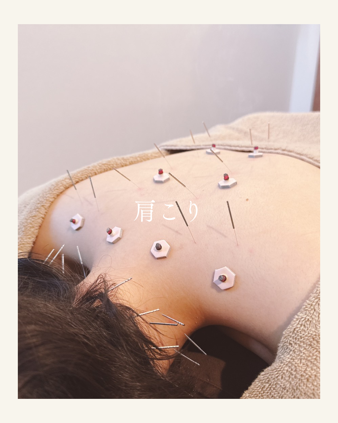 肋間神経痛の主な症状 (12)